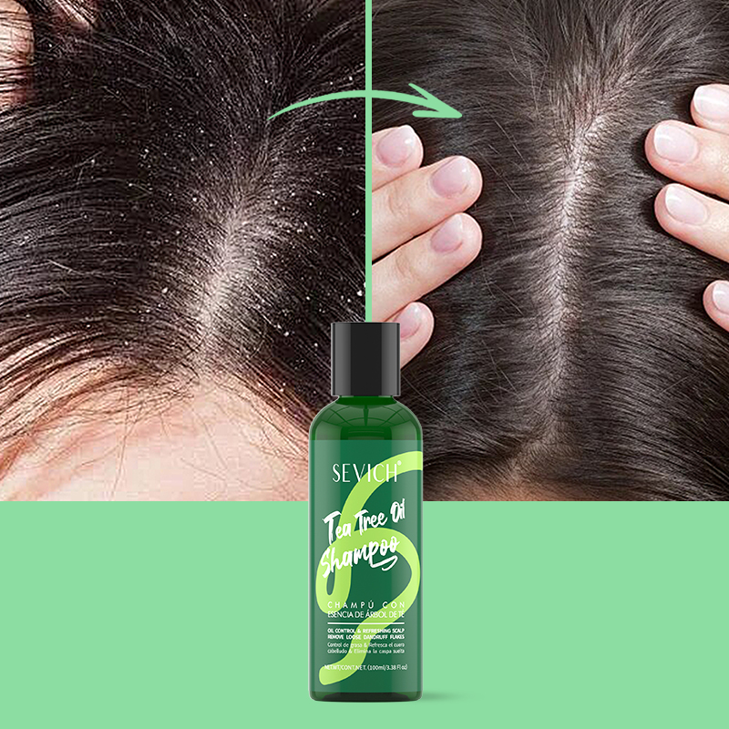Tea Tree Essence แชมพูครีมนวดผ - Hair Care Conditioner บทวิจารณ์และราคา